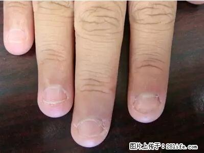 剪指甲、挖耳屎，这些日常小动作竟隐藏大危害！ - 鹰潭生活资讯 - 鹰潭28生活网 yingtan.28life.net